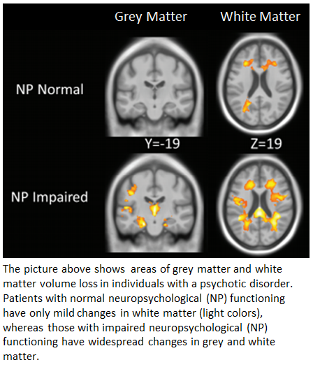 Woodward_Schiz Bull_NP normal and impaired psychosis fig
