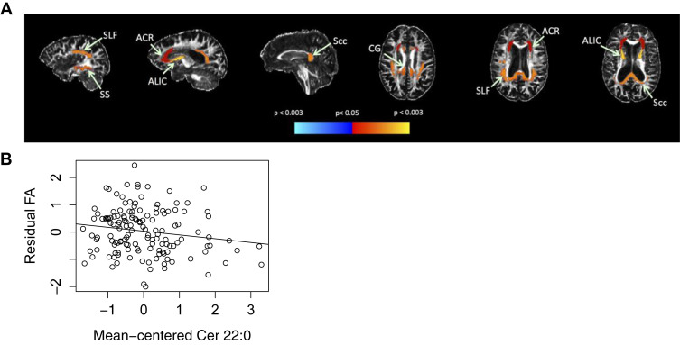 (A) Significant associations with plasma C22:0 and subsequent FA. (A) Red–yellow indicates higher plasma C22:0 associated with lower FA in white matter regions, while cyan–blue indicates higher plasma C22:0 associated with higher FA. Regional statistics are overlaid onto an FA image from a single subject; results are not corrected for multiple comparisons. (B) ACR FA by mean centered Cer 22:0. (B) Association between FA in ACR and Cer 22:0. The residual FA of ACR was calculated by regressing standardized FA on baseline age, sex, interval between blood draw and DTI, diabetes, BMI, scanner, and ratio of white matter lesions to intracranial volume. This is shown plotted against mean centered Cer 22:0 with a linear fit overlaid. Abbreviations: ACR, anterior corona radiata; ALIC, anterior limb of internal capsule; BMI, body mass index; CG, cingulum of cingulate gyrus; DTI, diffusion tensor imaging; FA, fractional anisotropy; Scc, splenium of corpus callosum; SLF, superior longitudinal fasciculus; SS, sagittal stratum. (For interpretation of the references to color in this figure legend, the reader is referred to the Web version of this article.)