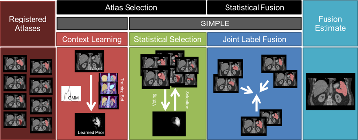 Flowchart of the proposed method. Given registered atlases with variable qualities, atlas selection and statistical fusion are considered as two necessary steps to obtain a reasonable fusion estimate of the target segmentation. The SIMPLE algorithm implicitly combines these two steps to fusion selected atlases; however, more information can be incorporated to improve the atlas segmentation, and a more advanced fusion technique can be used after the atlases are selected. We propose to (1) extract a probabilistic prior of the target segmentation by context learning to regularize the atlas selection in SIMPLE and (2) use Joint Label Fusion to obtain the final segmentation while characterizing of the correlated errors from among atlases.