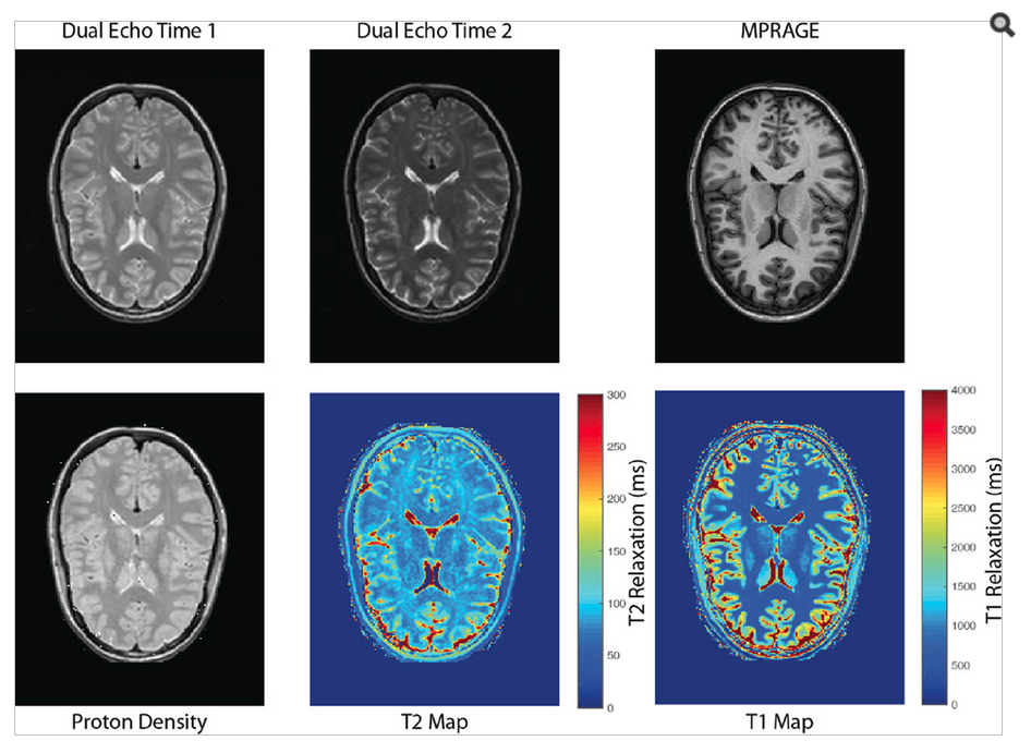 Intermediary results from image synthesis. The cited values for T2-relaxation in gray matter, white matter are approximately 100 and 80 ms respectively. The cited values for T1-relaxation in the gray matter and white matter are approximately 1350 and 800 ms respectively. These values appear consistent with the intermediary results of image synthesis.
