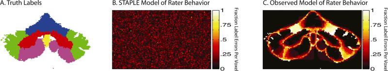 The inaccuracies of the STAPLE model of rater behavior. A representative slice from the truth model is shown in (A). The expected STAPLE model of rater behavior can be seen in (B). STAPLE operates under the assumption that there is a uniform probability that any given rater would mis-label a given voxel. The observed model of rater behavior can be seen in (C). The primary difference between (B) and (C) is that the human raters showed a clear inclination to mislabel boundary pixels and other ambiguous regions.