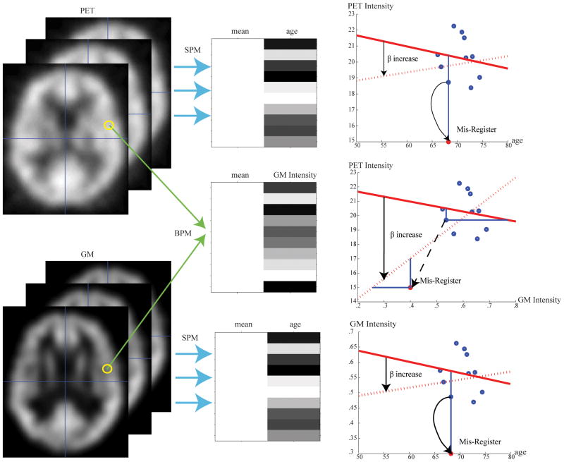 Increased sensitivity to outliers with BPM. Considered a simple one regressor situation, model y = βx + μ is used to fit data points in voxel wise analysis. In SPM, the imaging data (left column) lies along the y axis. (i.e., imaging data is treated as y in the fitted model.) The left column shows two sets of images data, PET blood flow maps (top row) and gray matter (GM) tissue density maps (lower row). The middle column shows the design matrix for each regression. Considered one voxel within mis-registration region, in separated analyses of these datasets with SPM (top and lower rows), a mis-registration induced outlier impacts only on data point in the y-direction. In a joint analysis with BPM, the outlier impacts both the x-axis and y-axis, and can result in dramatically different model fits. In the simulation the true β is a small negative value, but the outliers increase the estimated value of β to make it approximately zero or even a large positive number.