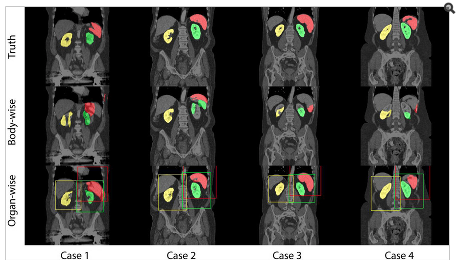 Qualitative comparisons between body-wise and organ-wise approaches on spleen (red), right kidney (yellow), and left kidney (blue). Padded bounding boxes in correspondent colors indicate the ROIs for organ-wise registrations.