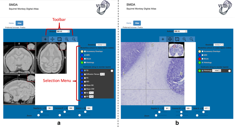 Atlas interface and functionality. The toolbars, menus, and display associated with MRI (a) and histology (b) modalities are shown