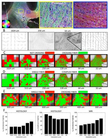 Fiber orientation estimation in a crossing fiber region. The results of structure tensor analysis on a myelin-stained histological slice shown as a color-coded orientation map (A), is shown zoomed in on two regions containing crossing (yellow box), and disperse (blue box) fibers. The resulting FODs are displayed at varying resolution levels (B). From the resulting FODs, voxels are characterized as crossing fiber (C; green) vs. not-crossing fibers (C; red), as well as single fiber (D; red) vs. complex fibers (D; green), at all resolutions. Note that “not-crossing” voxels are those that with single fiber populations in addition to complex fibers that do not contain two discrete local maxima. Voxels from diffusion MRI in the same region are also displayed as single fiber (E; red) vs. crossing fibers (E; green). Histograms for this specific region of interest show percentages of crossing fibers (F; left) and percentages of complex fibers (F; middle) for histology, as well as percentage of crossing fibers (F; right) for dMRI.