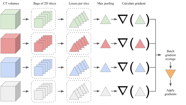 Figure 2 Illustration of multiple instance learning with gradient accumulation.  The first CT volume is organized into a bag of its 2D slices.  Then, the model performs inference on all slices in the bag, and class probabilities are calculated.  The gradient is calculated only for the instance corresponding to the most probable positive class.  This gradient is saved and the gradient calculation is repeated for the next bag until the batch is done, and the accumulated gradient is averaged for the batch size and applied to the model.