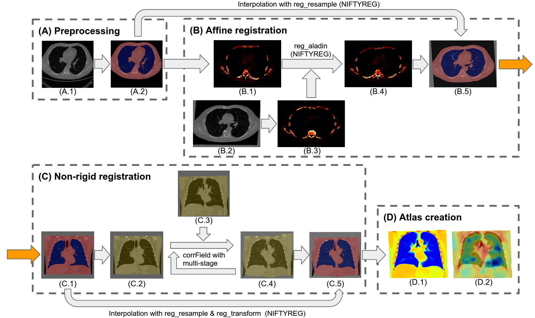 Figure. Four consecutive modules of the atlas creation pipeline. (A) Preprocessing module: (A.1) original moving scan; (A.2) the overlap between the ambient removed scan and lung & body segmentation masks. (B) Affine registration module based on NiftyReg toolbox: (B.1) moving scan with intensity window (0, 1000); (B.2) axial view of reference scan; (B.3) reference scan with intensity window (0, 1000); (B.4) affine registered intensity windowed moving scan; (B.5) interpolation of the preprocessed moving scan with the affine registration transformation matrix. (C) Non-rigid registration module based on corrField (registration) and NiftyReg (interpolation): (C.1) affine registered moving scan overlapped with lung and body segmentation masks; (C.2) overlapped with non-NaN region mask; (C.3) reference scan with non-NaN region mask; (C.4) non-rigid deformed moving scan overlapped with deformed non-NaN region mask; (C.5) non-rigid deformed moving scan overlapped with deformed lung / body masks. (D) Atlas creation module: (D.1) average atlas of HU; (D.2) average atlas of Jacobian determinant map.