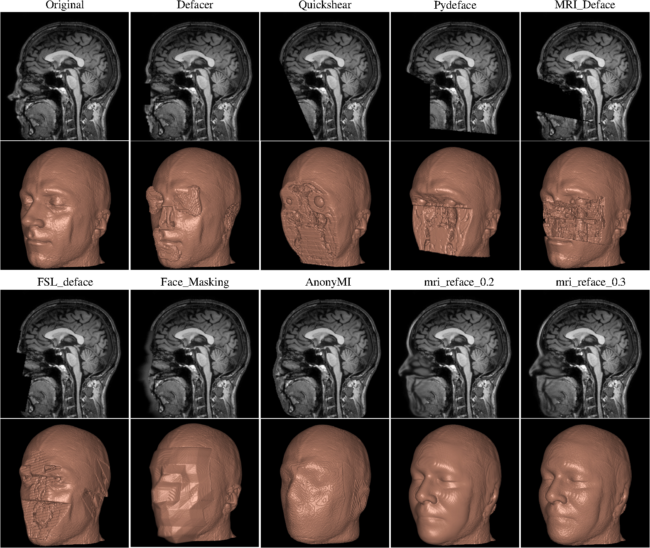 A sagittal slice of an MRI is displayed over the reconstruction of the whole head MRI. Top set of images from left to right is the acquired MRI and then defacing using Defacer, QuickShear, Pydeface, and MRI_Deface. The bottom set of images from left to right is defacing using FSL_Deface, Face_Masking, AnonyMI, mri_reface_0.2, and mri_reface_0.3.