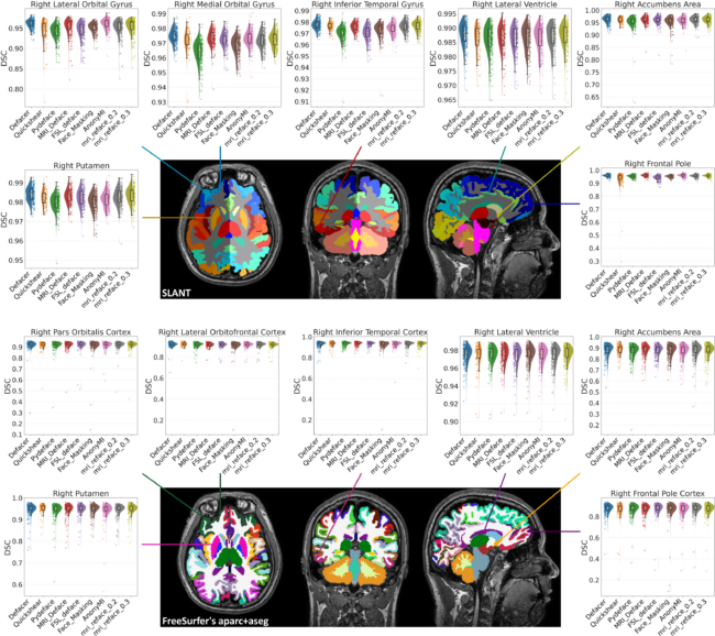 DSC for the segmentation (of SLANT or FreeSurfer) between unaltered and defaced images for seven ROIs for subjects from the OASIS-3 cohort. The top collection of images shows SLANT labels on a particular subject from the OASIS-3 cohort. Surrounding the MRI are seven raincloud plots that correspond to specific ROIs. The bottom collection of images shows the FreeSurfer labels for the same OASIS-3 subject and raincloud plots for anatomically comparable ROIs.