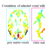In resting state BOLD fMRI signals there are expected correlations between grey matter voxels which can be used to 
identify anatomical regions7
(left). In a similar manner, we hypothesize correlations can be identified between white matter voxels 
(right), providing evidence there may be informative white matter correlations in resting state BOLD fMRI data.