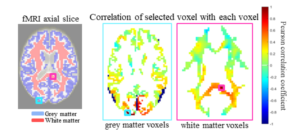 In resting state BOLD fMRI signals there are expected correlations between grey matter voxels which can be used to identify anatomical regions7 (left). In a similar manner, we hypothesize correlations can be identified between white matter voxels (right), providing evidence there may be informative white matter correlations in resting state BOLD fMRI data. 