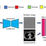 Figure 3. We perform kernel conversion on paired hard and soft CT kernel images using a pix2pix GAN. The generator, a U-Net, takes as input the source CT kernel image and predicts a residue image. The output kernel is obtained by adding the residue image to the input source kernel image. The discriminator, a PatchGAN, takes as input the generated image and the input kernel, and outputs the probability of the generated image being a translated version of the input.
