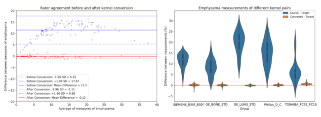 Figure 4. Left: Bland Altman plots are constructed to show agreement between kernels for emphysema measurements before and after conversion for the Siemens vendor. The dashed lines represent the confidence intervals while the solid lines represent the mean bias between the two kernels for a given measurement. Right: Distribution of percent differences before conversion showcases a lack of agreement across the different kernel pairs from different manufacturers. Prior to conversion, there is a disparity between the measurements. Kernel conversion reduces the difference in measurements, bringing the mean difference close to zero.